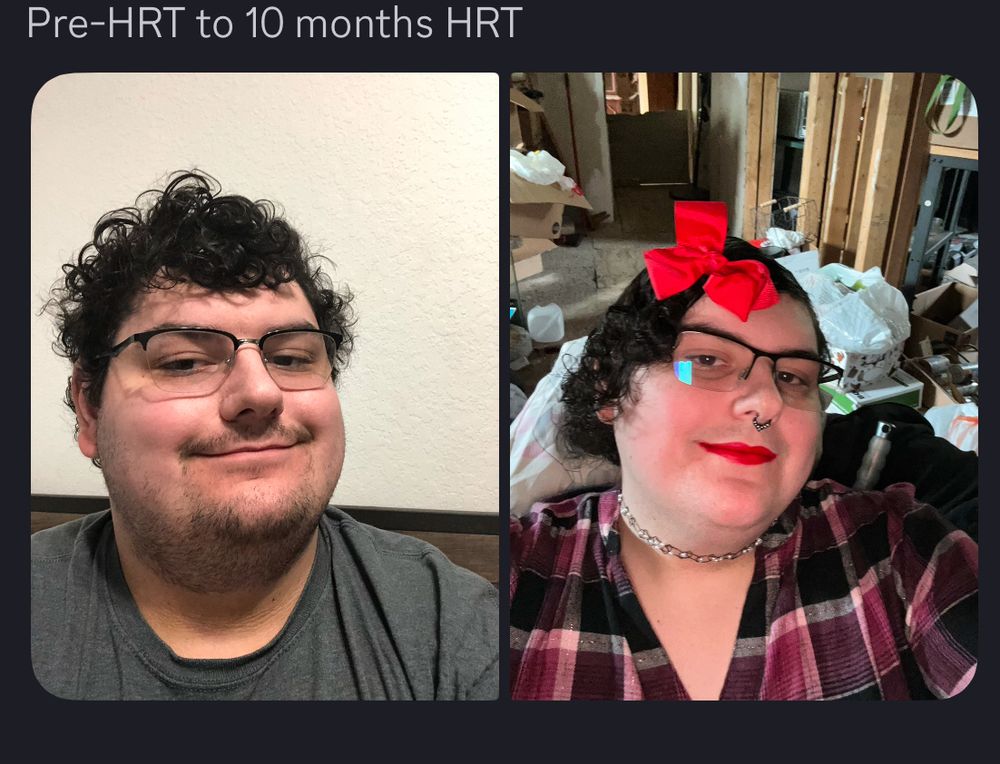 Pre-HRT me compared to 10 months on HRT me