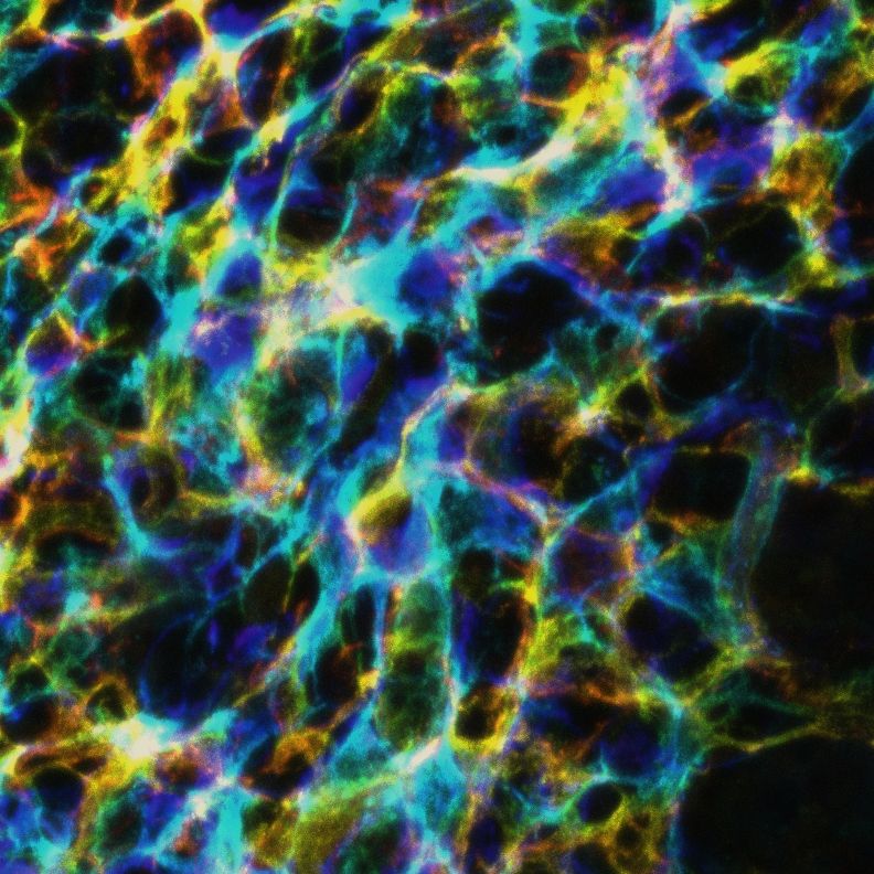 A psychedelic-looking image of what a network of cells (follicular dendritic cells in a lymph node). 