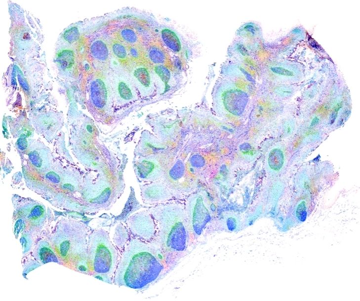 Human tonsil stained with 17 markers, inverted look up table
