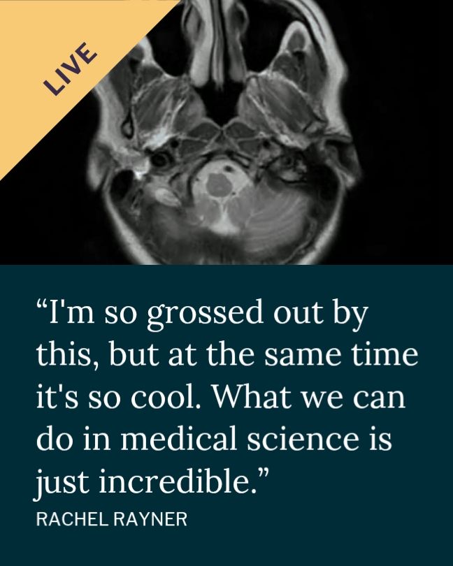 A moving mri image of the brain. Text reads: I'm so grossed out by this, but at the same time it's so cool. What we can do in medical science is incredible."