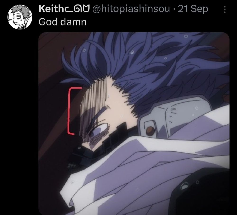 Photo displaying Hitoshi Shinso's massive fucking forehead