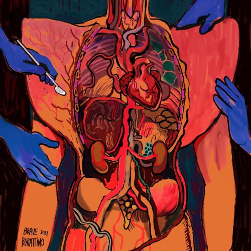 Digital painting of a human flayed so that all their internal organs are exposed from the neck to the naval. Two pairs of blue gloved hands are operating. They hold the layer of flesh that once covered the rib cage open. One hand wields a scalpel. 