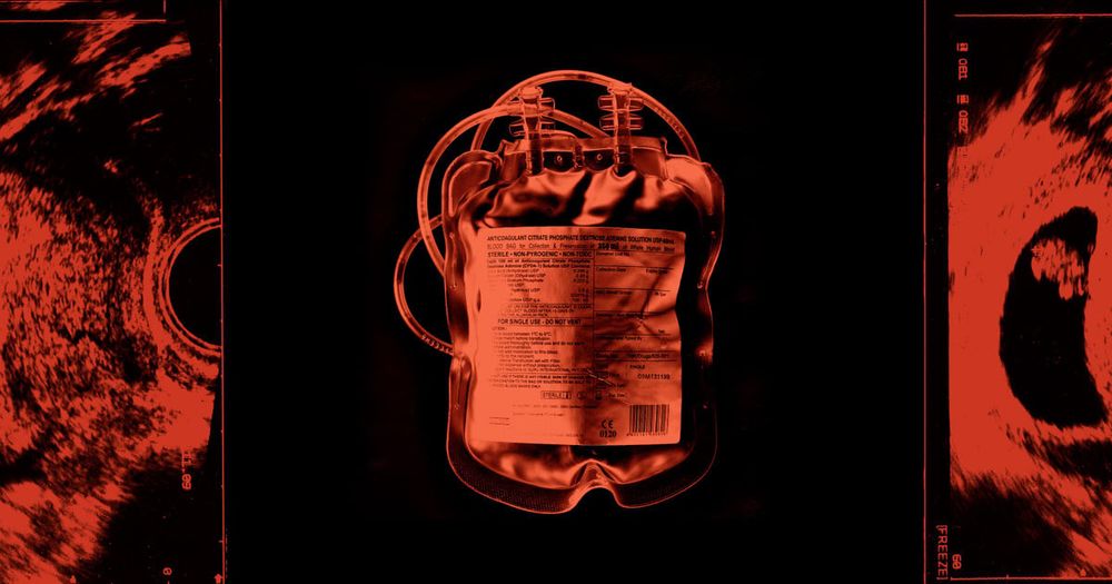 A new ProPublica data analysis adds to the mounting evidence that abortion bans have made the common experience of first-trimester miscarriage far more dangerous.