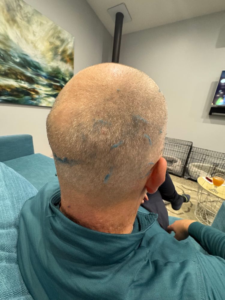 Fluff caught on my hat which is cropped short. Lots of green fluff all over