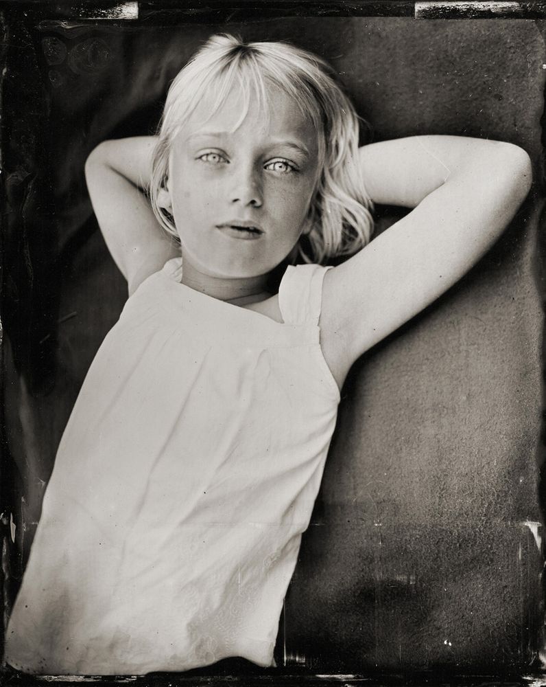 A wet plate collodion portrait of a girl - she is lying down and staring directly into the camera - she has white hair and bright eyes.