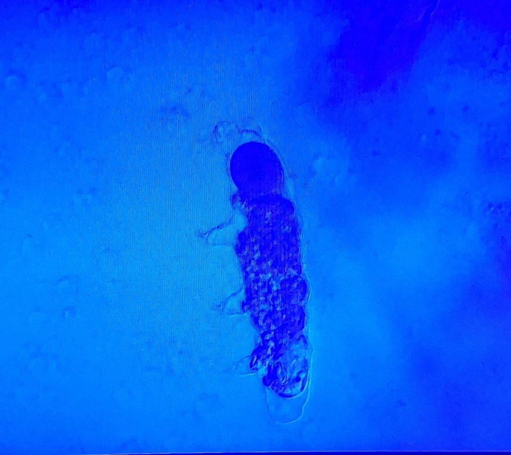 View of tardigrade from a microscope, taken at Artis microbiology museum in Amsterdam