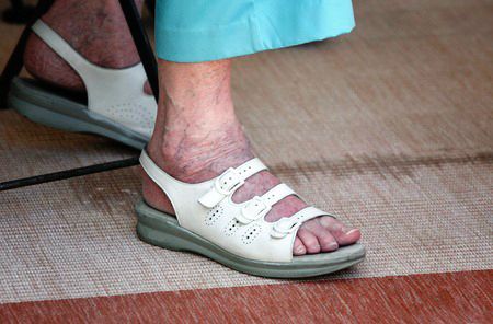 A photo of my 70 something year old feet wearing my smart looking 3 strap leather orthopedic sandals. I’m wearing turquoise cropped polyester slacks. 