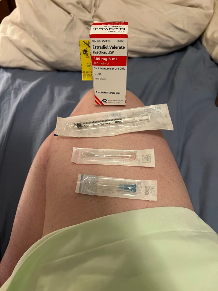 A photo of a Estradiol Valerate box, syringe, draw needle, and injection needle balanced on someone's leg.