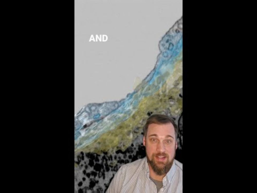 Good Holes in the #Liver | #science #cell #biology