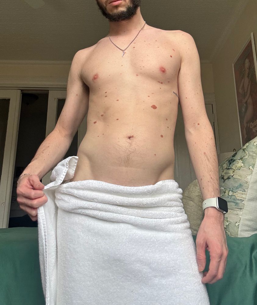 Headless selfie of me undoing a towel wrapped around my waist. 