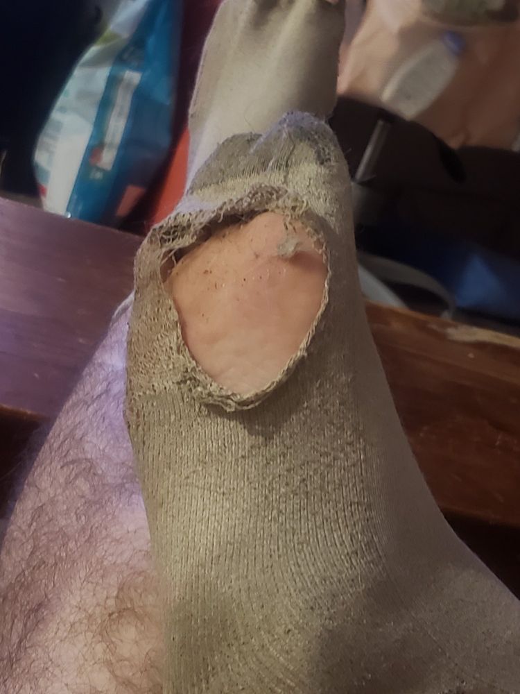 giant hole in the bottom of my dirty socks