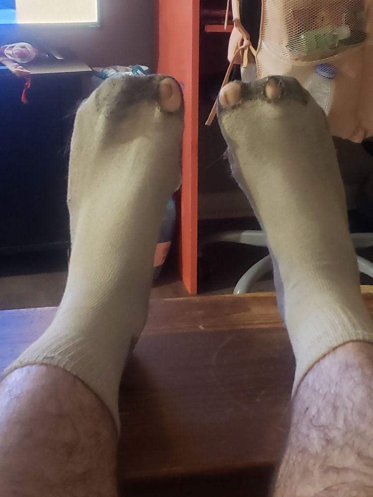 my dirty socks with toe holes in them