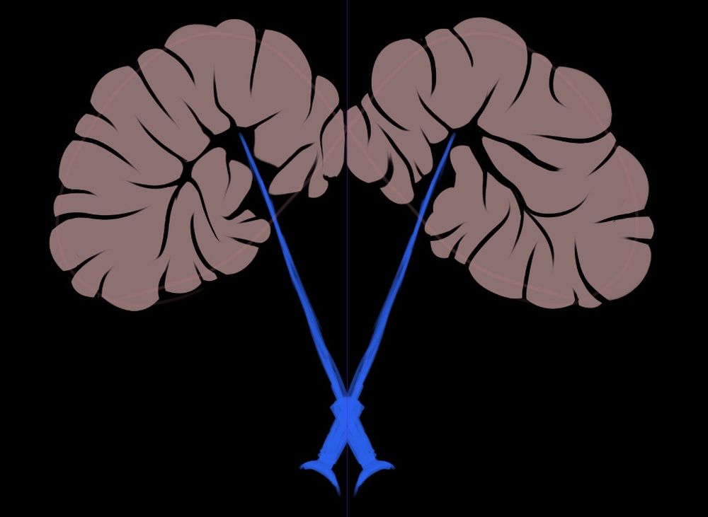 MetaVerse company logo, M is formed by diseased brain tissue, V is 2 icepicks