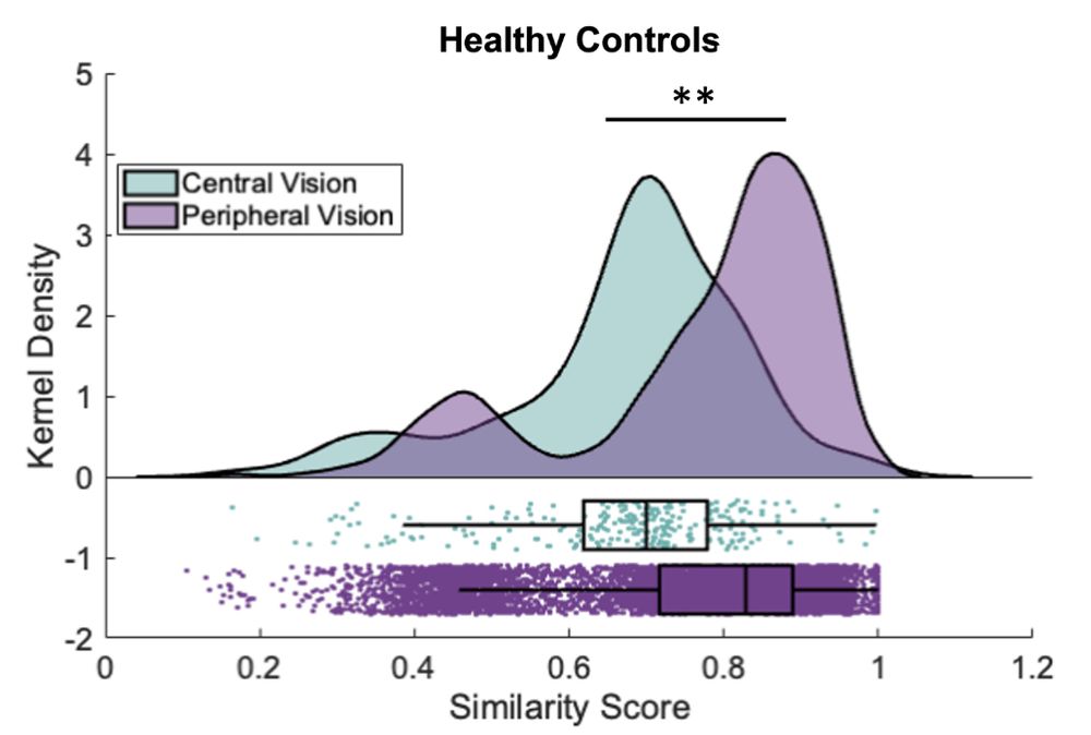 stronger similarity of connection patterns for peripheral vision than central.