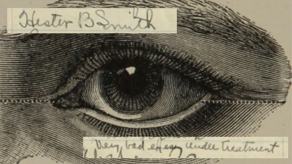Close up line drawing of an eye with superimposed handwriting that reads "Hester B. Smith" and "very bad eyes under treatment"