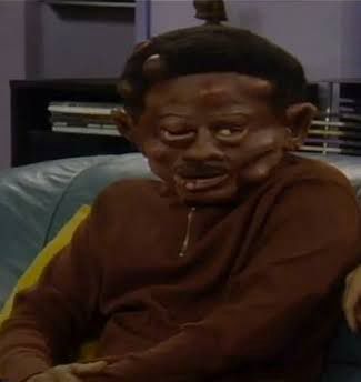 Man in a brown shirt sitting in a sofa in an apartment with a severely swollen and knotted head (made up for TV)