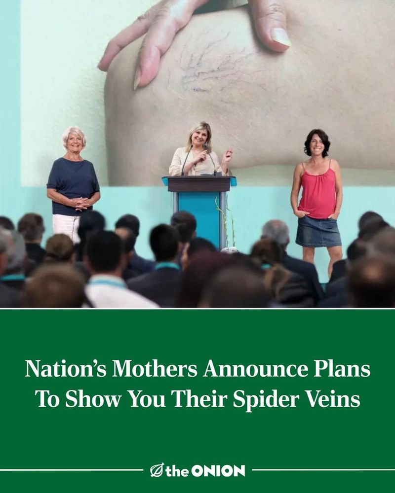 Nation’s Mothers Announce Plans To Show You Their Spider Veins