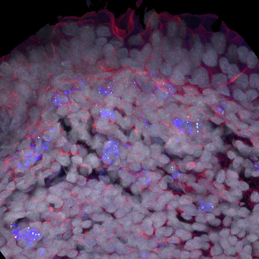 Photo shows fgTiO2 specifically targeting auto fluorescent, antigen-presenting cells of the Peyer's patch. 