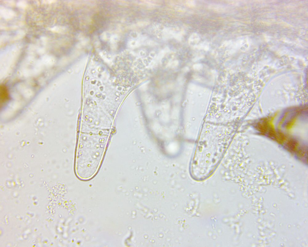 Surface of the stigma is seen on the upper part as round and clear cells, with some cells showing finger-like clear extensions (papillae) extending down wards into the light-gray background. Microscopy of fresh flowers of Alstroemeria. (c Lena Struwe, 2024)