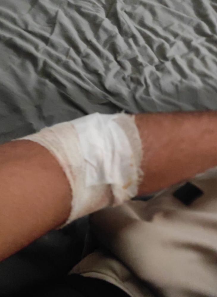 Photo prise en envoyée par Anas montrant son bras dans un bandage au niveau du coude
