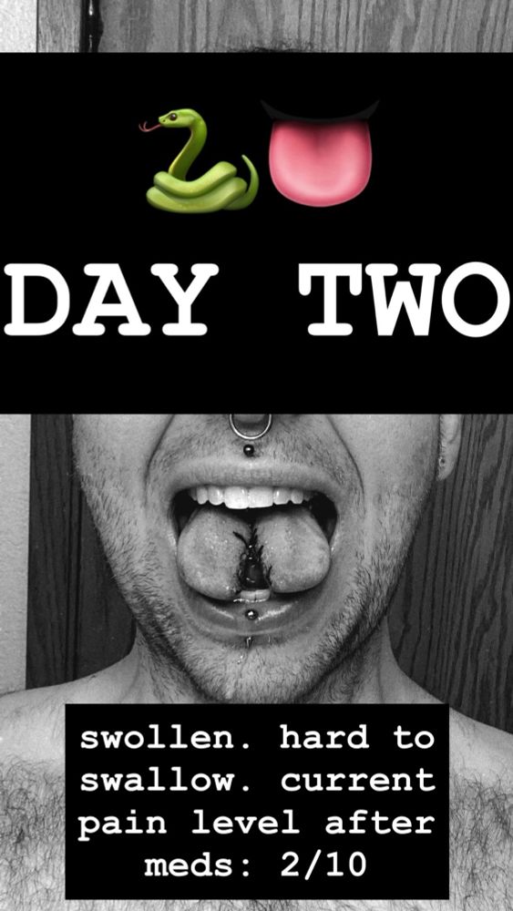 Queso, sticking his split tongue out and smiling through the pain, while drooling. Day 2