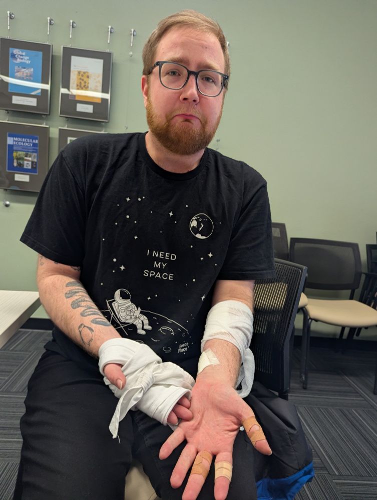 Dylan wearing multiple wound dressings, bandages and plasters after learning how to treat different types of wounds.