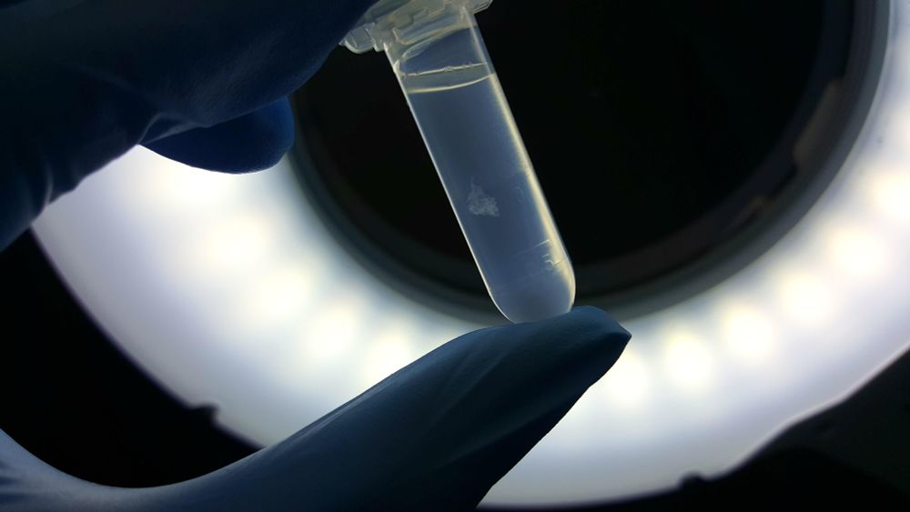 The picture shows the precipitated DNA of a 🐬 using alcohol&salt.