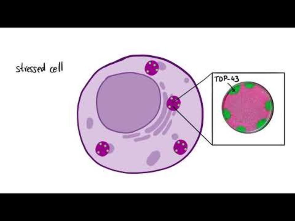 Condensates Inside Condensates—Triggering Disease?
