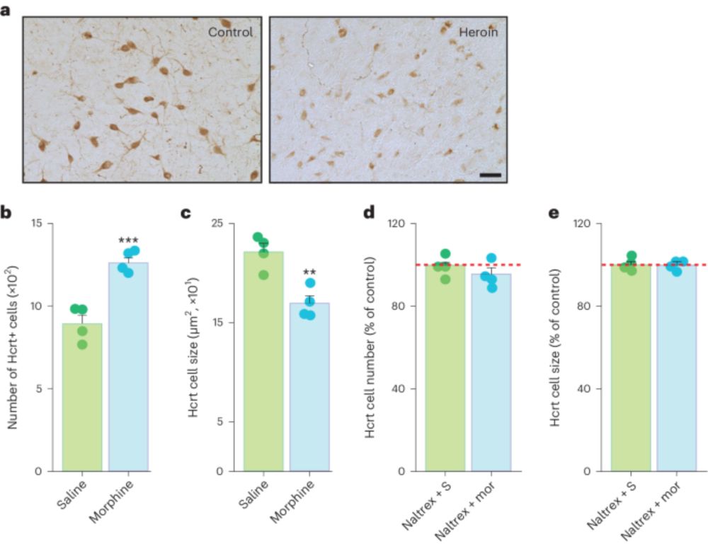 Opioid-induced neuroanatomical, microglial and behavioral changes are blocked by suvorexant without diminishing opioid analgesia - Nature Mental Health