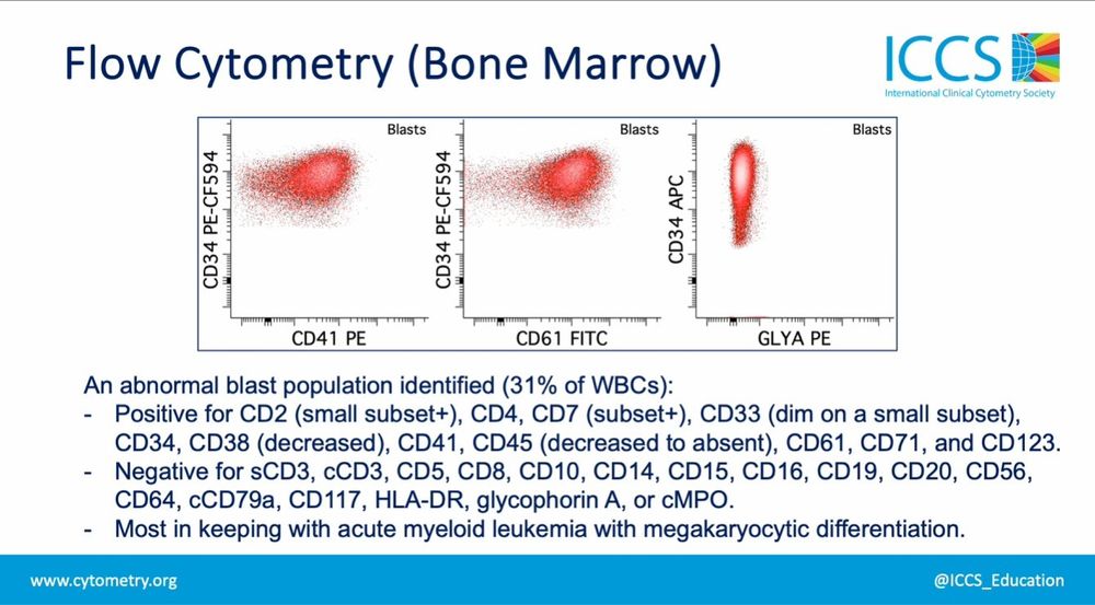 A slide from the latest video for ICCS members discussing acute megakaryoblastic leukemia, transient abnormal myelopoiesis, and acute myeloid leukemia with RAM phenotype through a case-based approach. The video presents classic flow cytometry findings as well as key clinical features and diagnostic criteria for each entity.