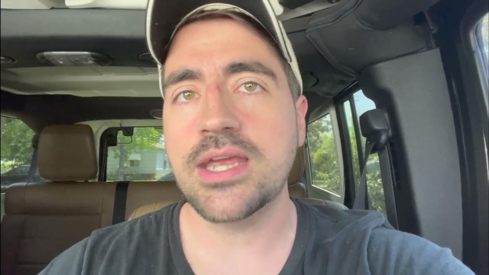 Liberal Redneck - How Bad is Trump's Whole Brain Situation?