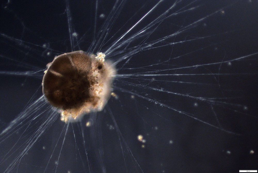 An image of a live foraminifera around 200 microns in diameter with long pseudopodia 