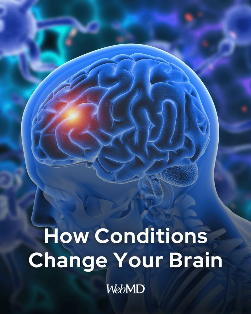 Brain