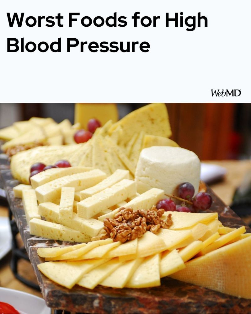 Cheese Plate