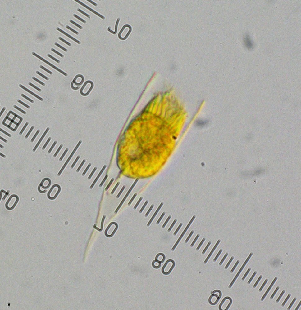 A microscope slide with scale bar, with a tintinnid in focus. A yellow-stained protozoan that lives in a clear wineglass shaped ‘lorica’ or ‘test’