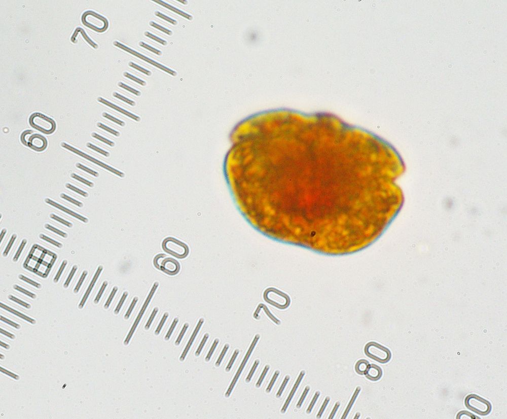 A really wide Karenia microalgae cell, stained yellow with Lugol’s media. Its nucleus is a round red patch, centrally located in the cell. The cell is 40 microns wide and 27 microns tall, with a waistline marking the top quadrant of the cell, and a distinct node on its apex