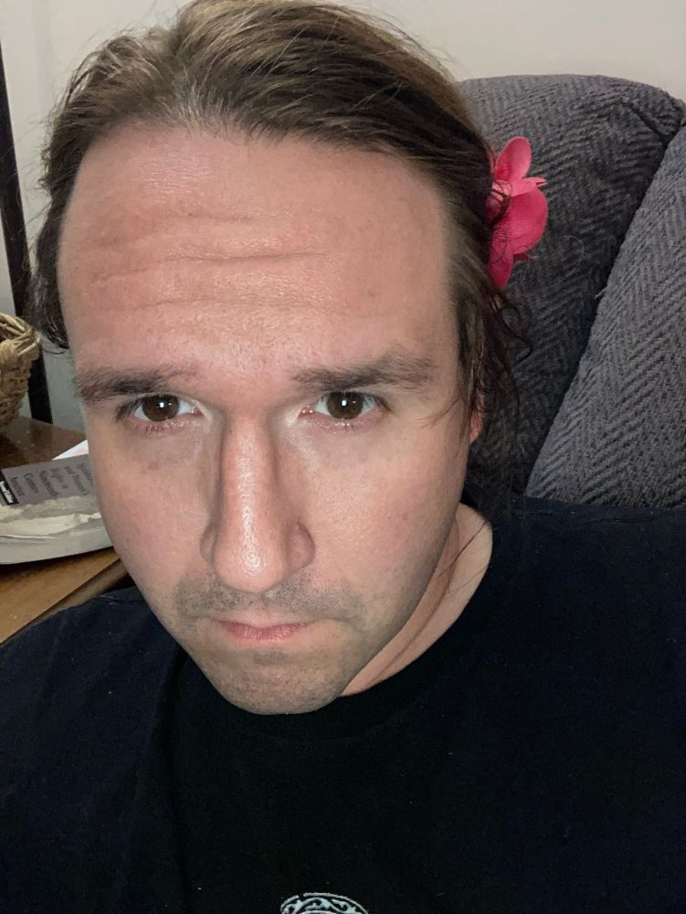 Picture of Arkania in September 2021. She is wearing a t-shirt and has a a significant amount of stubble. Her brown eyes are staring off center and a bit sad. 