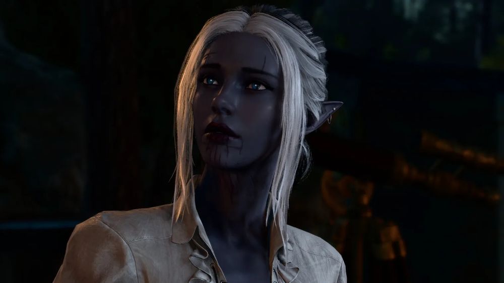 Elegys, a half drow with dark grey skin, blue eyes and facial scars. Her hair is white and black.