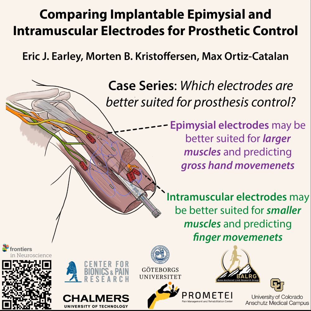 A graphic of the musculature and nerves in an amputated arm with an osseointegrated implant extending from the skin.
Title: "Comparing Implantable Epimysial and Intramuscular Electrodes for Prosthetic Control"
Authors: Eric J Earley, Morten B Kristoffersen, Max Ortiz-Catalan

Caption: Case Series - Which electrodes are better suited for prosthesis control? Epimysial electrodes may be better suited for larger muscles and predicting gross hand movements. Intramuscular electrodes may be better suited for smaller muscles and predicting finger movements.