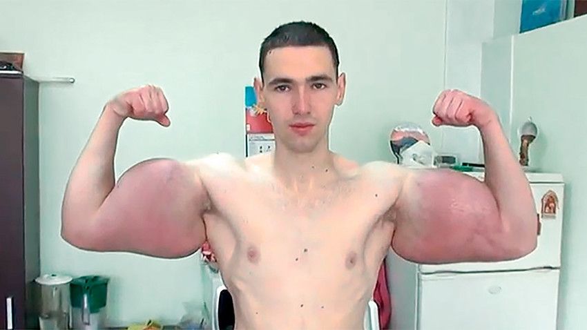 kirill, that russian bodybuilder who died from injecting heinous shit into his body that gave him irl anchor arms