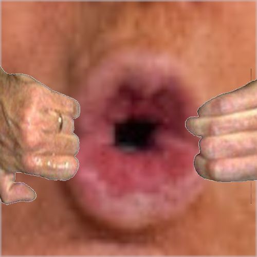 trumps mun med goatse hands