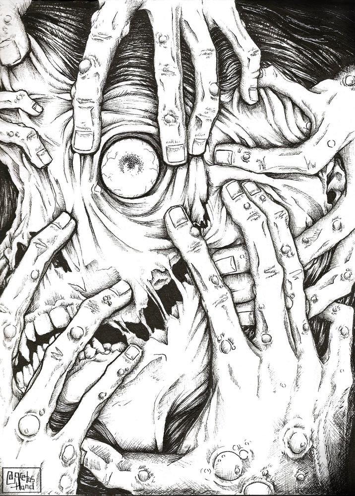Black and white ink drawing of hands covered in boils clawing at a distorted, horrific face. On the left hand side the nose and mouth take on a mummified look, the mouth trails into skin being torn in half, forming the facsimile of a smile that leads up to the right eye. The right eye is surrounded by a blanket of loose skin being pulled in multiple directions by the hands-- fingers holding the eye socket open and the eye ball completely exposed. The placement and perspective of the facial features are irrespective of each other. The illustration is inked using micron pens.