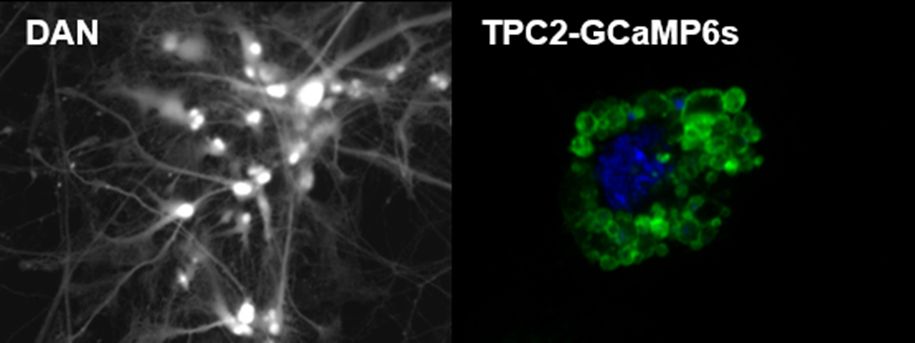 The Patel lab published on Ca++/#Parkinson’s disease, indicating a new #pharmacological route to impede the disease.  Funded by @wellcometrust and @ParkinsonsUK;  collaborated with scientists from Brazil, York, @ucl, #KCL, California, Germany, India doi: 10.1083/jcb.202412055 