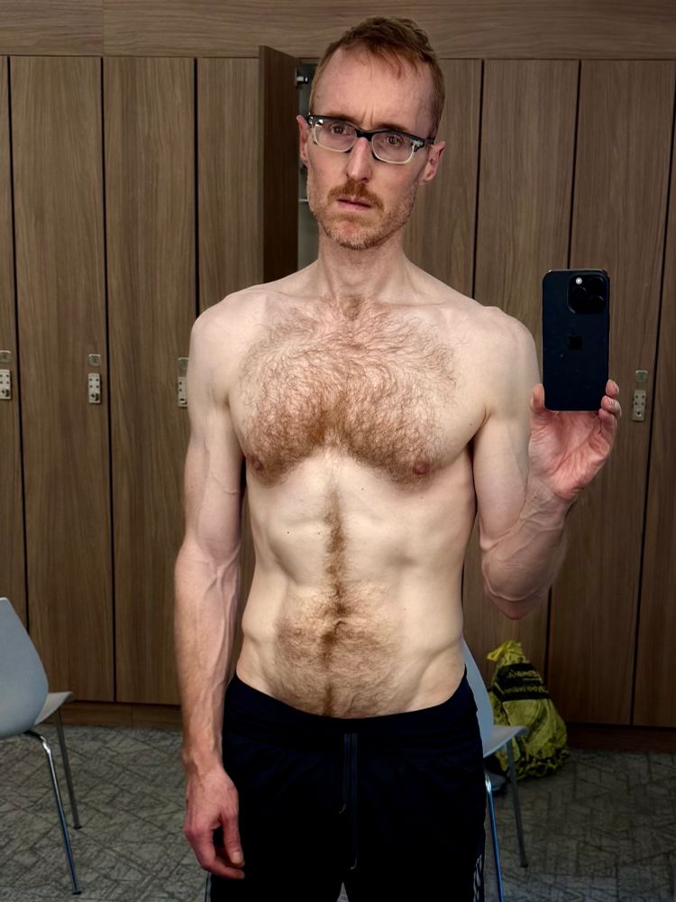 Sad-faced clown of a man whose shirt is missing (again!).