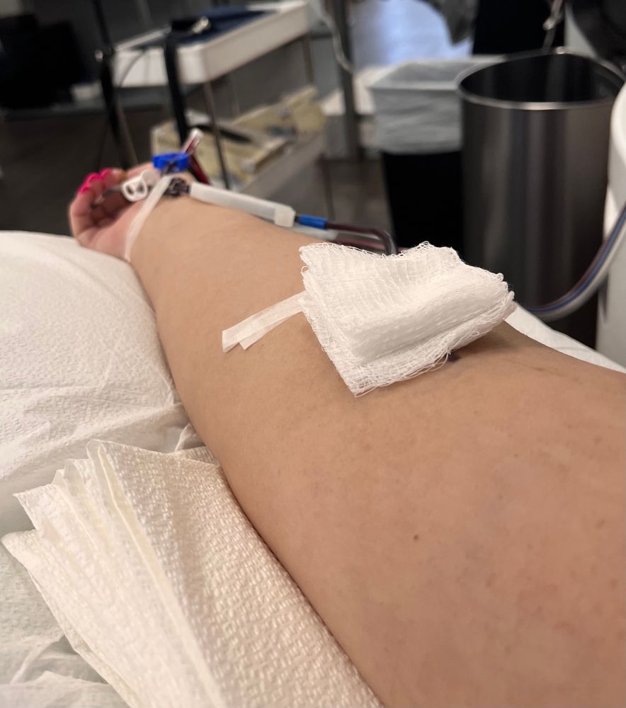 Arm extended to show end of platelet donation. 