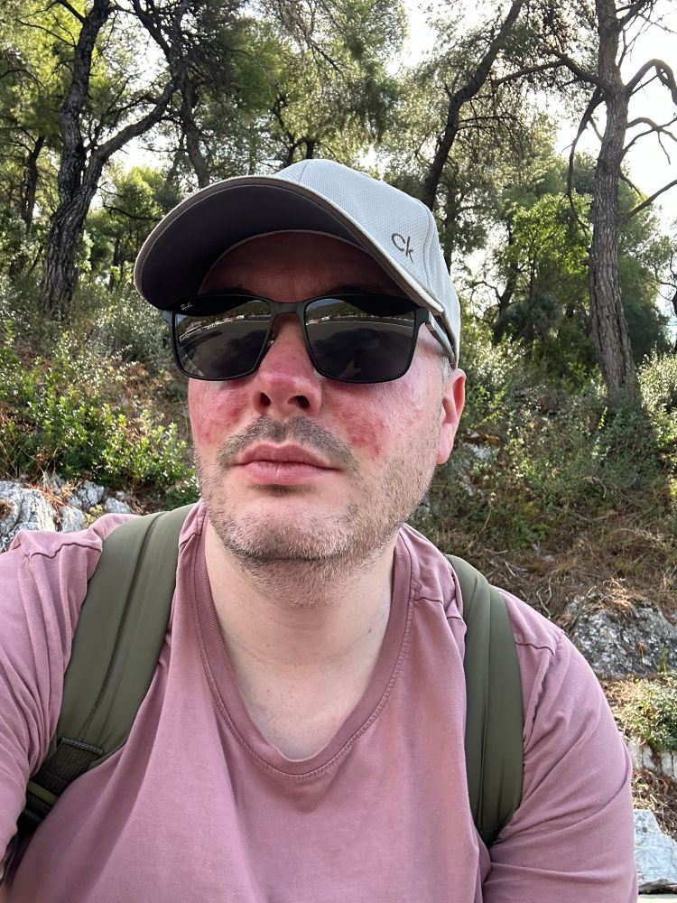 Me in front of a pine forest