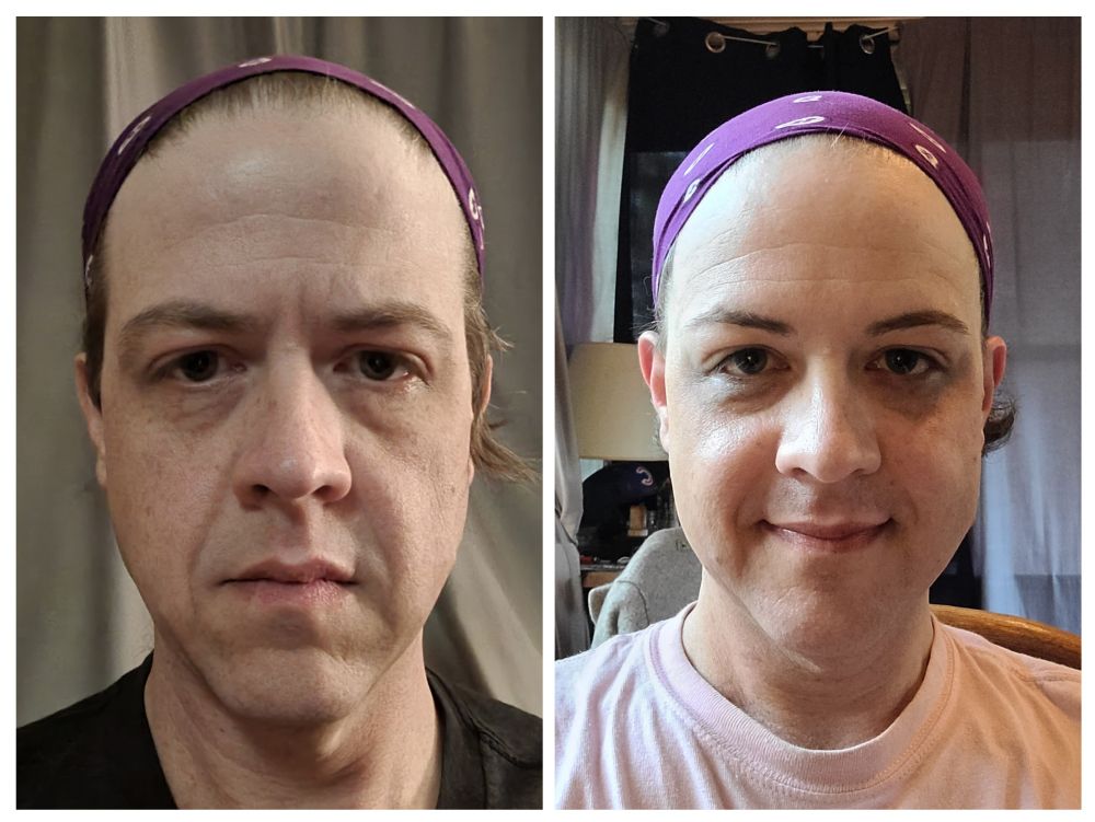 Side by side Comparison pictures of me before and after coming out. 