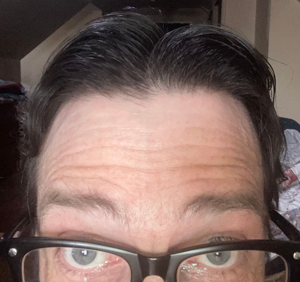 Close up of my stylish hair and wrinkly forehead