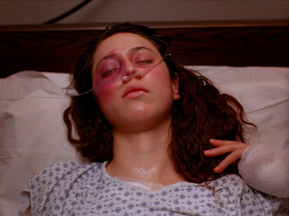 Ronette Pulaski in a coma at Twin Peaks Hospital. Twin Peaks S01E01 - Northwest Passage.