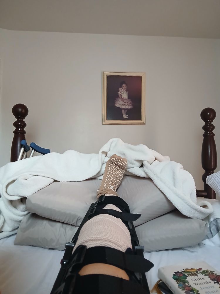 Picture of a braced and bandaged leg propped up on pillows. On the wall is a picture of a young girl wearing a frilly white dress with red accents.